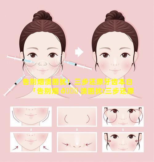 告别烟渍困扰！三步还原牙齿本白「告别烟 🐟 渍困扰!三步还原牙齿本白」